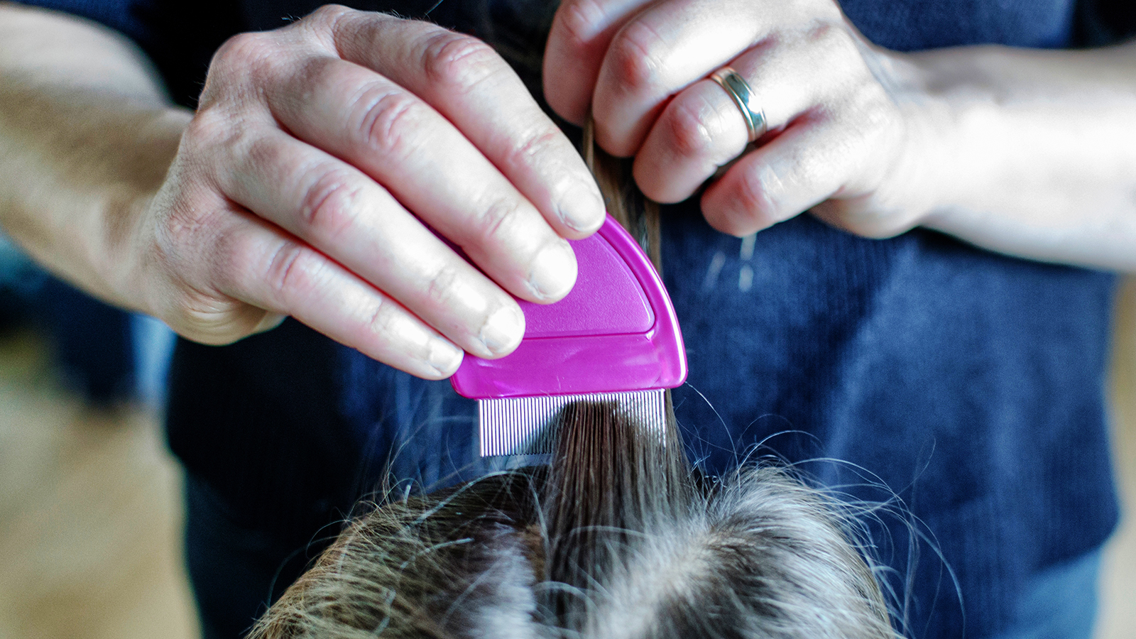 Know how to get rid of hair lice naturally at home  HealthShots